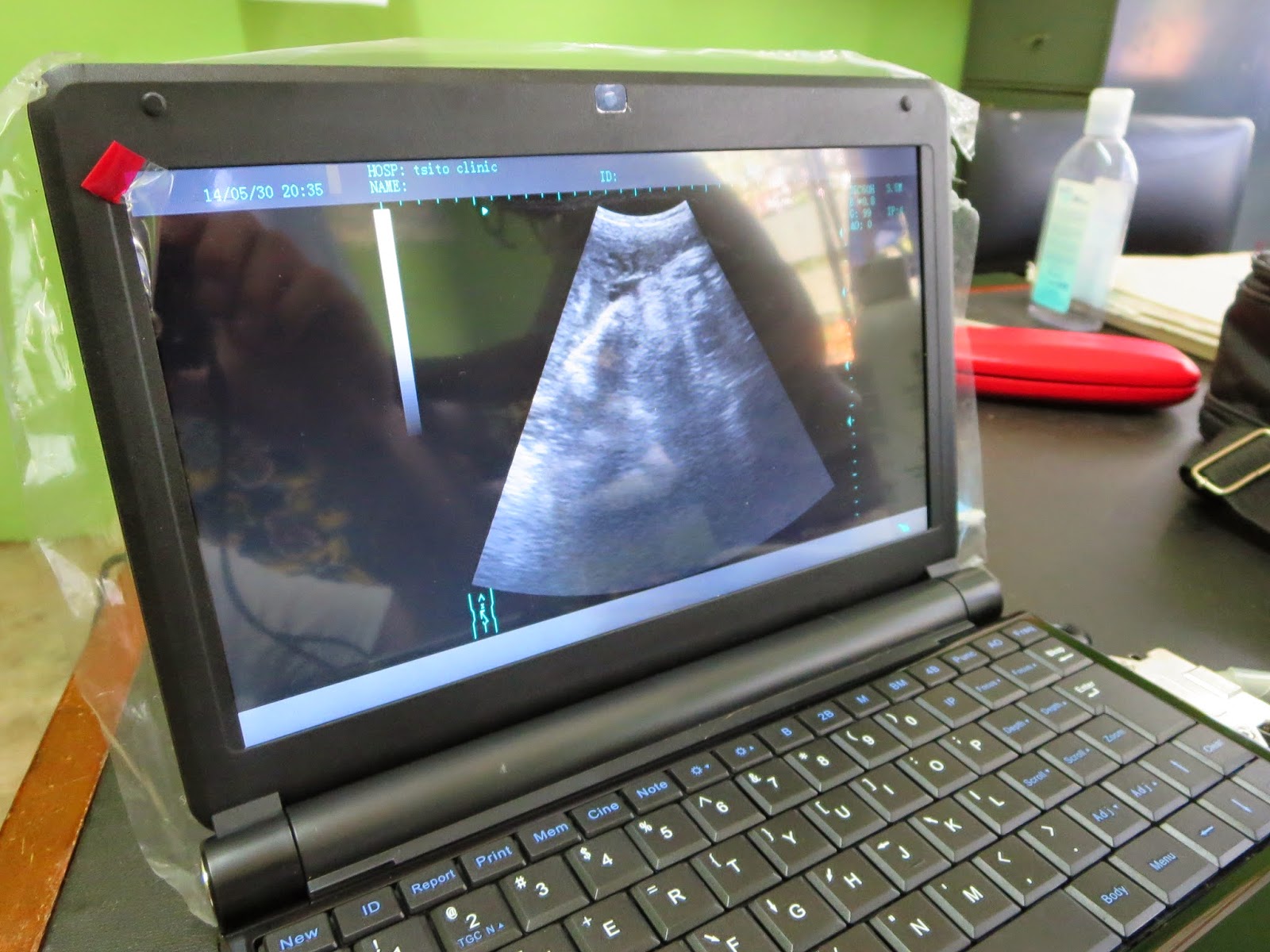 Scan shot on a laptop